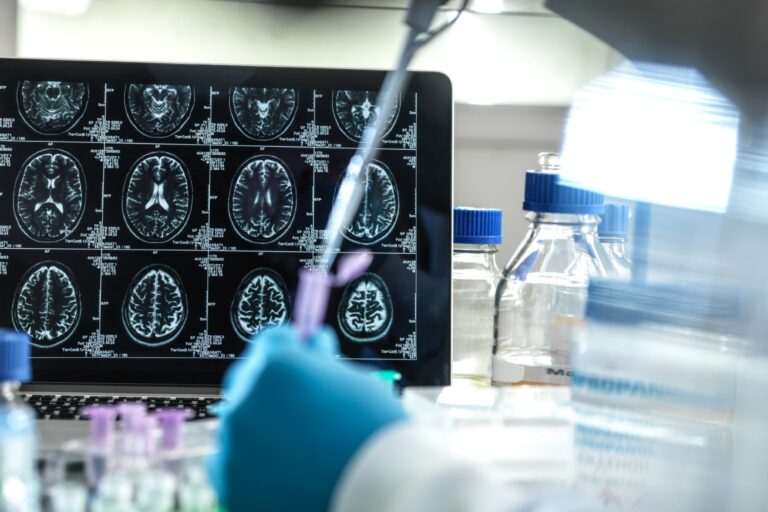 Clinical research to develop a possible cure for Alzheimer's and dementia in the lab. (TEK IMAGE/SCIENCE PHOTO LIBRARY/GETTY IMAGES)