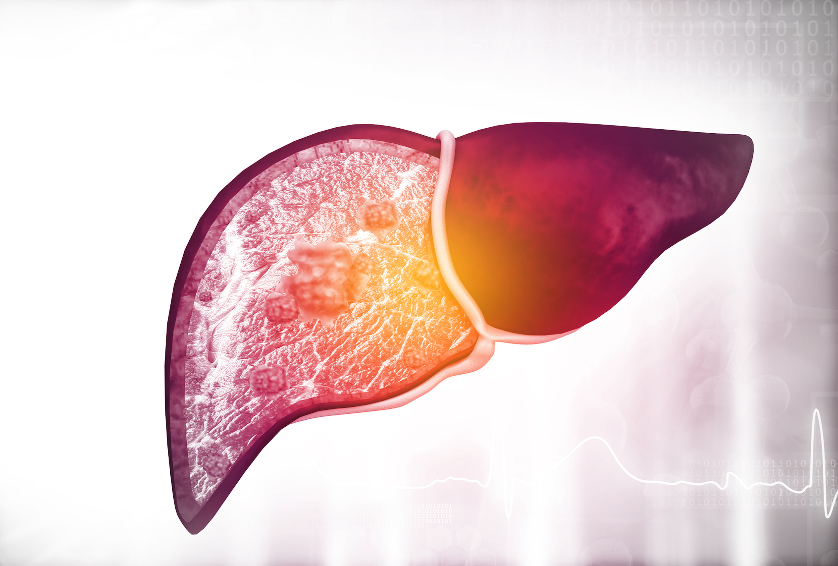 Diseased human liver on science background. 3D illustration (Rasi Bhadramani via Getty Images) (Getty Images)