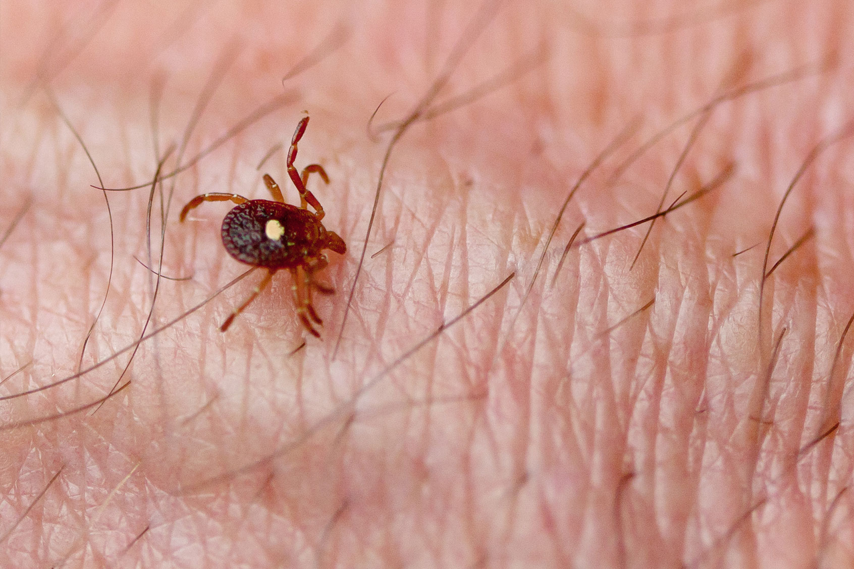 Lone Star Tick (Amblyomma americanum) on human skin (Getty Images/epantha)
