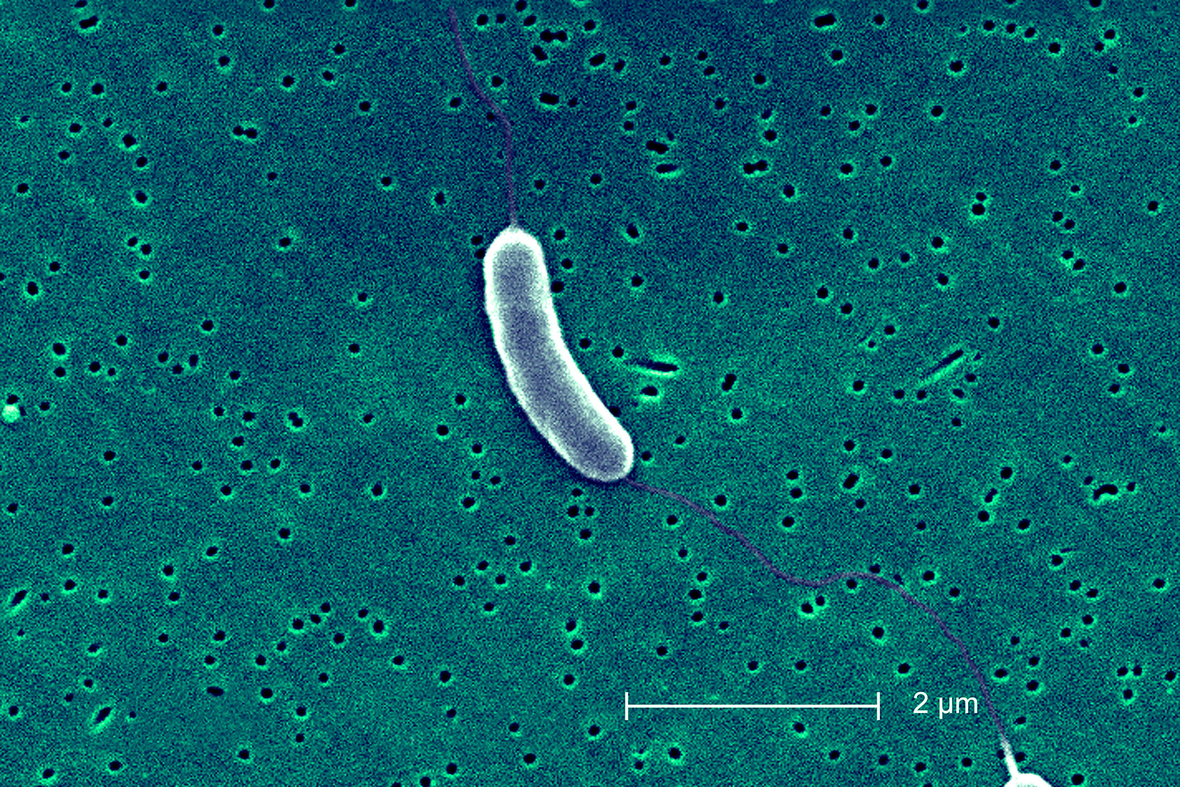 This Scanning Electron Micrograph Sem Depicts A Flagellated Vibrio Vulnificus Bacterium; Mag. 13184X. (BSIP/UIG Via Getty Images)