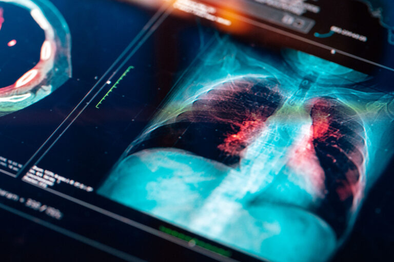 Medical MRI Scan (Getty Images/da-kuk)