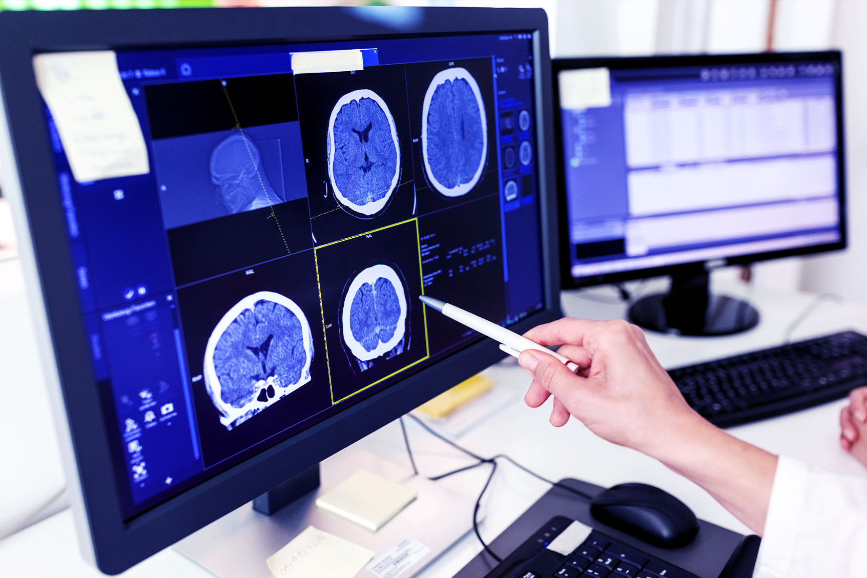 Doctor looking at CT scan (Getty Images/1440525438)