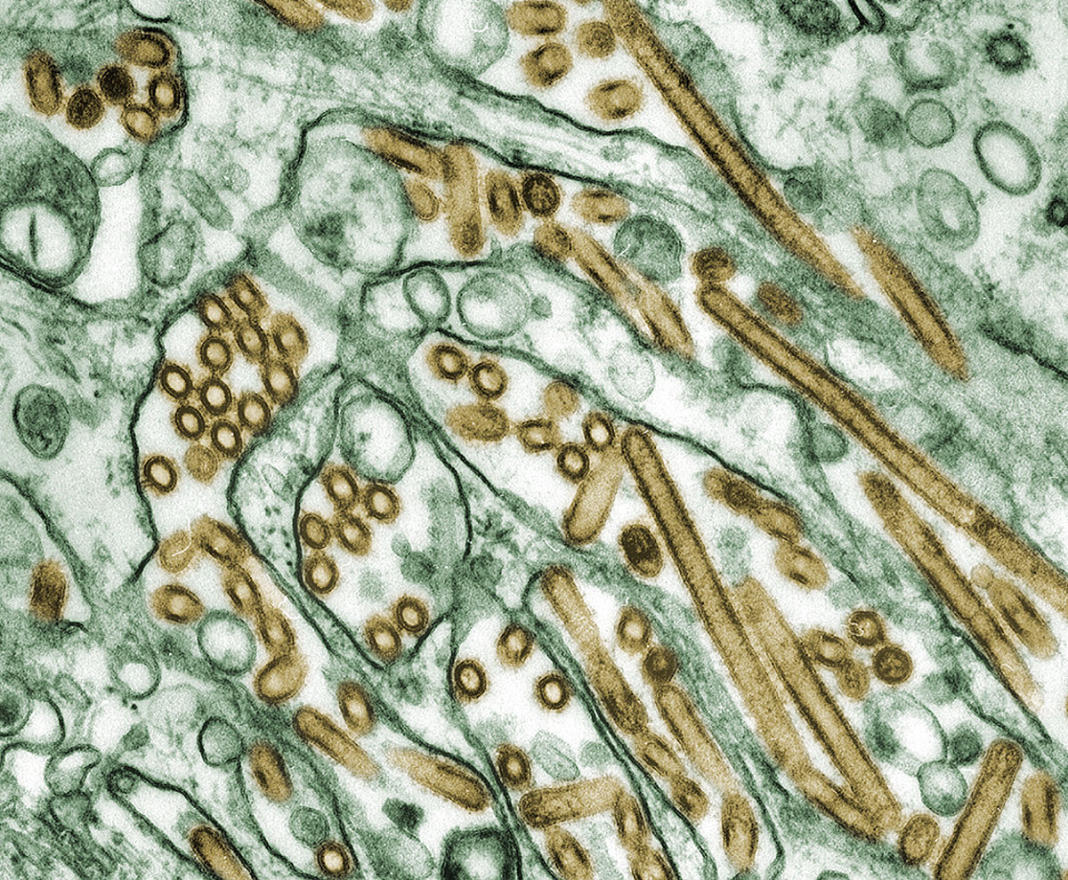 Avian influenza H5N1 virus microscopic