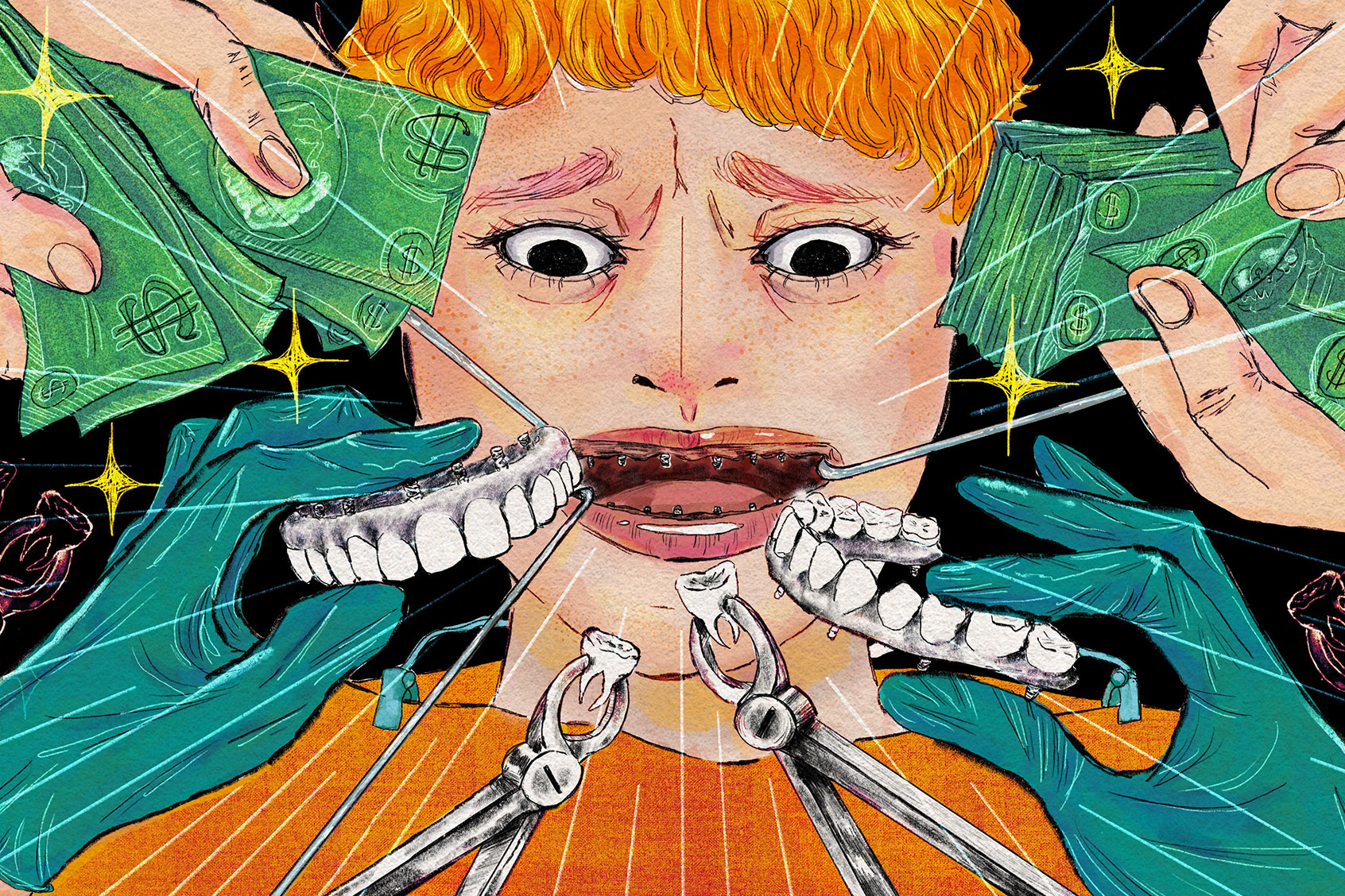 Dental Nightmares (Illustration by Oona Zenda/KFF News)