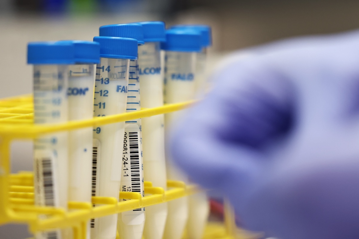 Milk samples are seen as HDC receiving staff prep them for testing at the Animal Health Diagnostic Center at Cornell University on December 10, 2024 in Ithaca, New York. (Photo by Michael M. Santiago/Getty Images)