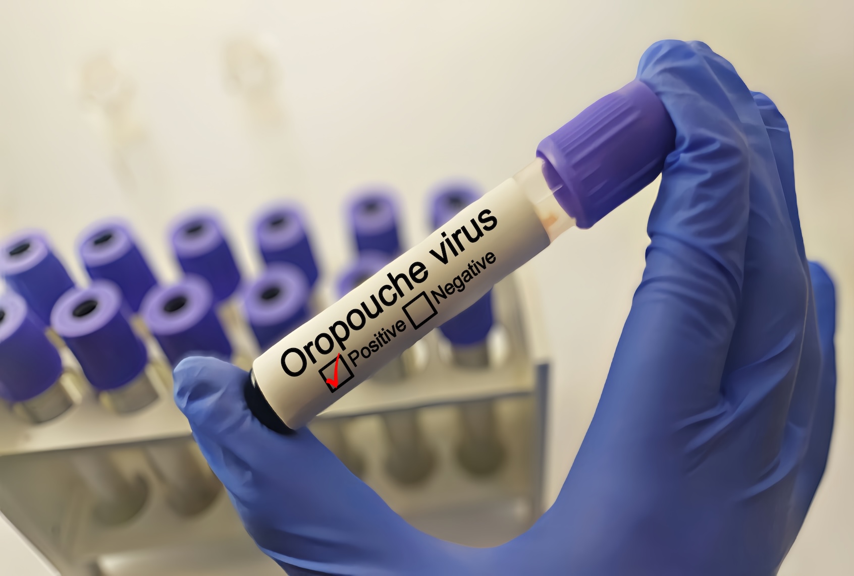 Doctor with Oropouche virus positive blood sample. (Fania Witardiana / Getty Images)