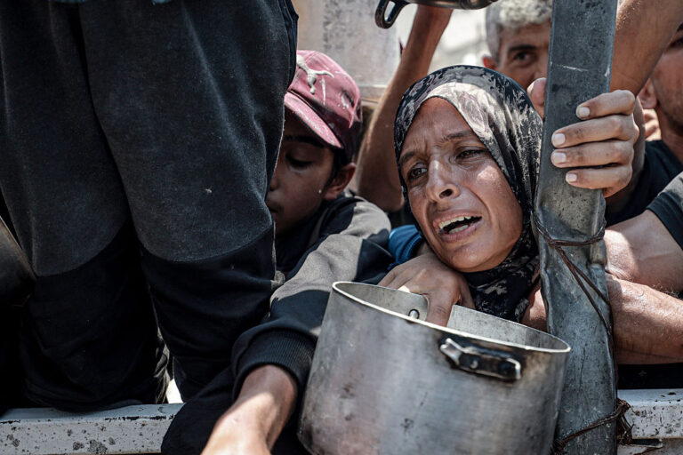 People in Gaza are starving due to aid cuts, splitting Allied responses to the crisis (Khames Alrefi / Anadolu / Getty Images)
