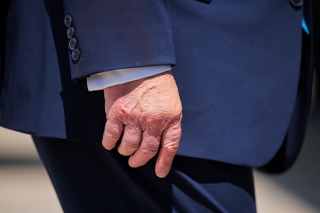 With another visit to Walter Reed this week, President Trump's health is back under scrutiny as people continue to speculate about his bruised hands, swollen ankles and rambling communications. (Chip Somodevilla / Getty Images)