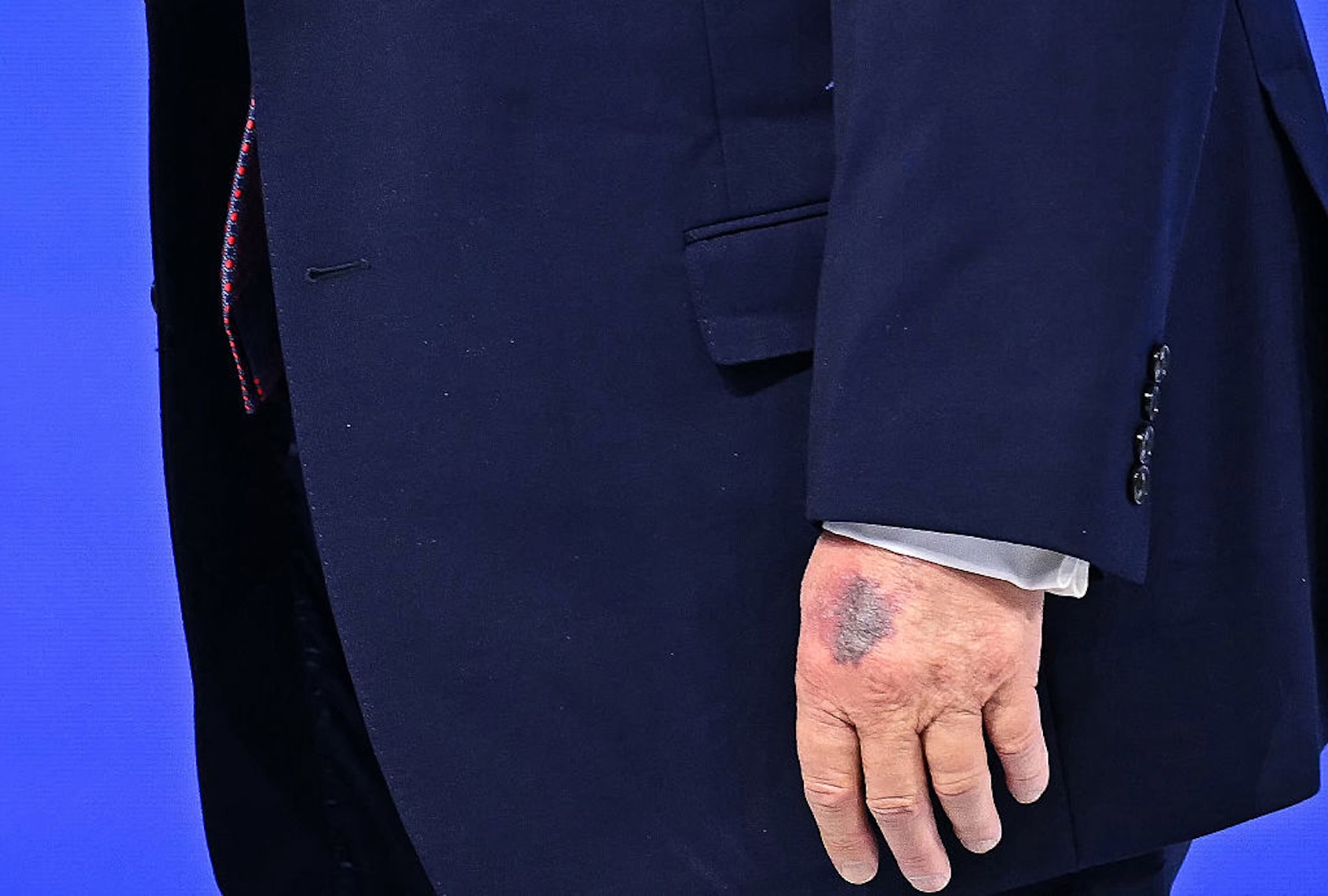 Speculation continues to rise about the state of Donald Trump's physical and mental health (Fabrice COFFRINI / AFP via Getty Images)